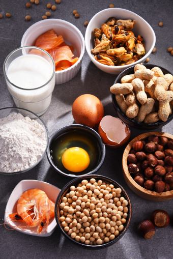 Major Food Allergens